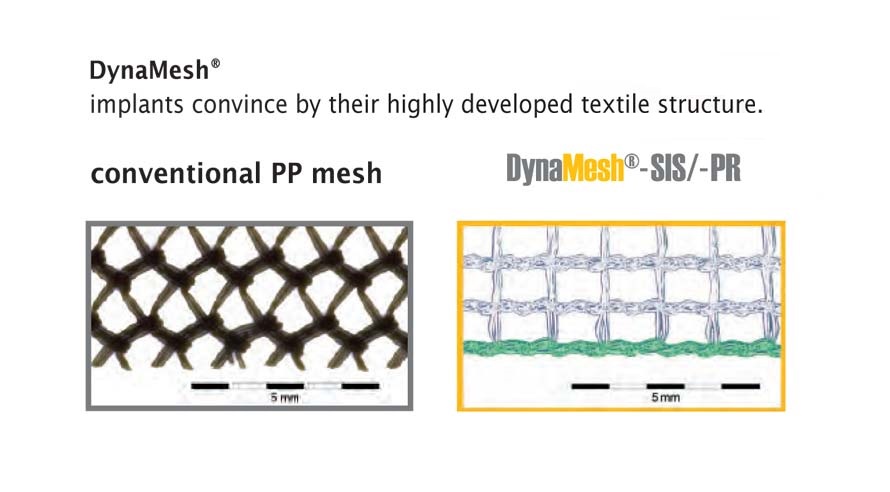 DynaMesh SIS & PR - Mesh implants for pelvic floor surgery - Surgical ...